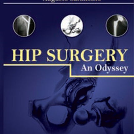 Hip Surgery: An Odyssey