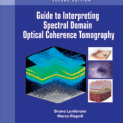 Guide to Interpreting Spectral Domain Optical Coherence Tomography