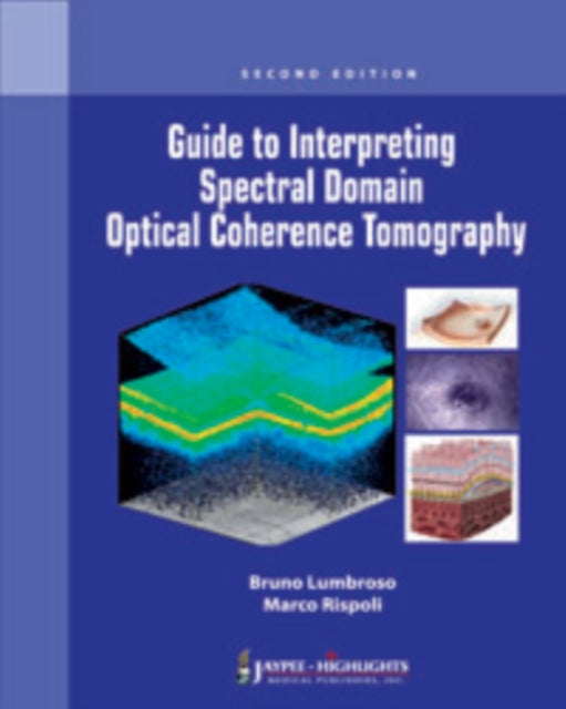 Guide to Interpreting Spectral Domain Optical Coherence Tomography