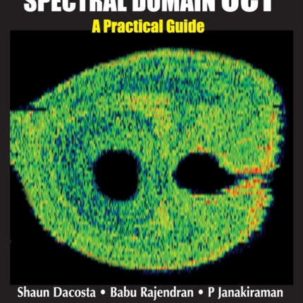 Spectral Domain OCT: A Practical Guide