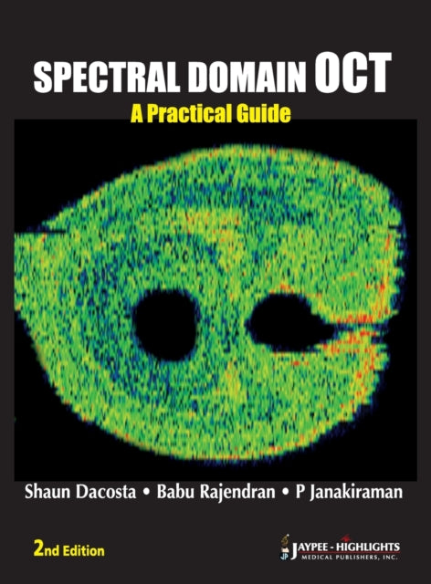 Spectral Domain OCT: A Practical Guide