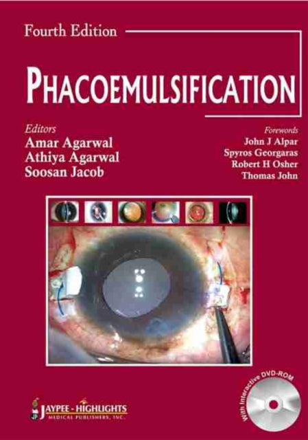 Phacoemulsification, Fourth Edition