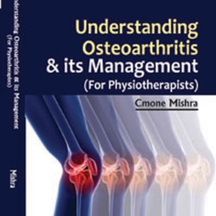 Understanding Osteoarthritis and its Management