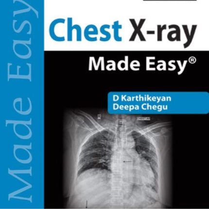 Chest X-ray Made Easy