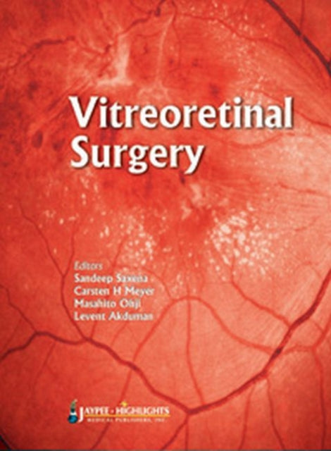 Vitreoretinal  Surgery