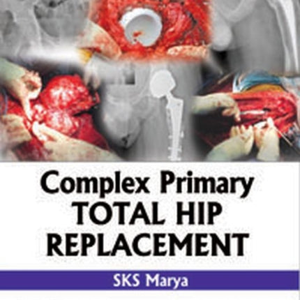 Complex Primary Total Hip Replacement