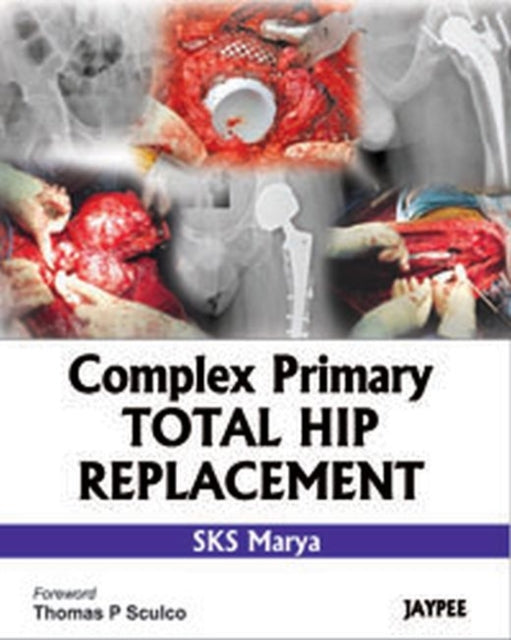 Complex Primary Total Hip Replacement