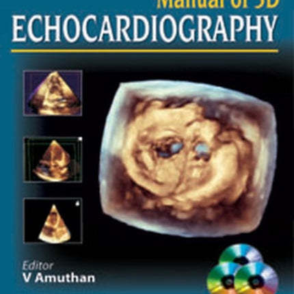 Manual of 3D Echocardiography