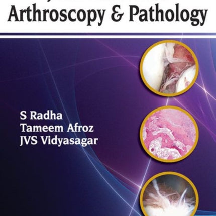 Handbook of Joint Disorders Arthroscopy & Pathology