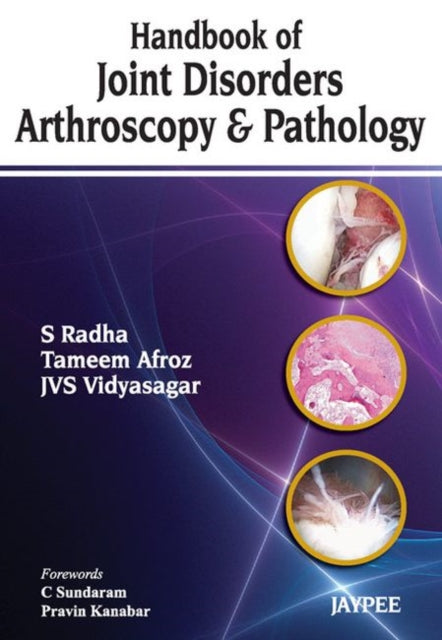 Handbook of Joint Disorders Arthroscopy & Pathology