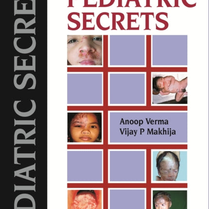 Pediatric Secrets