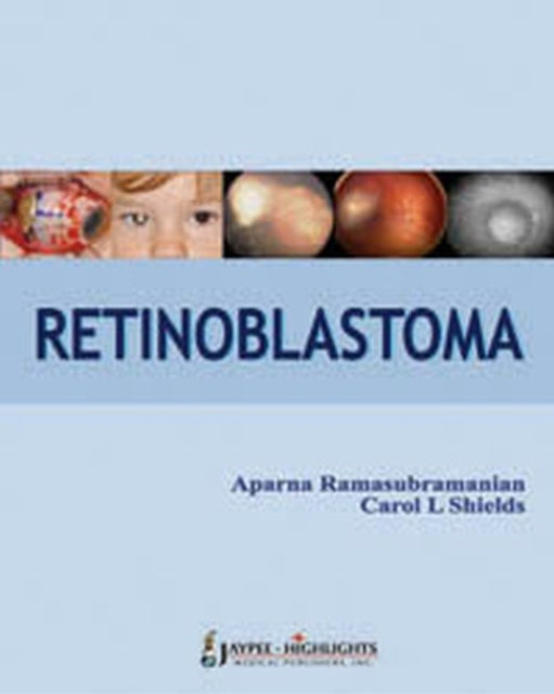 Retinoblastoma