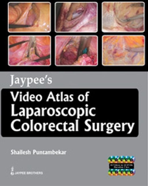 Jaypees Video Atlas of  Laparoscopic Colorectal Surgery