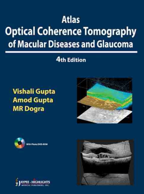 Atlas Optical Coherence Tomography of Macular Diseases and Glaucoma