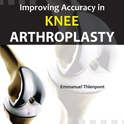 Improving Accuracy in Knee Arthroplasty