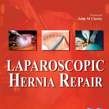 Laparoscopic Hernia Repair