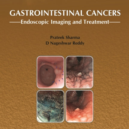 Gastrointestinal Cancers