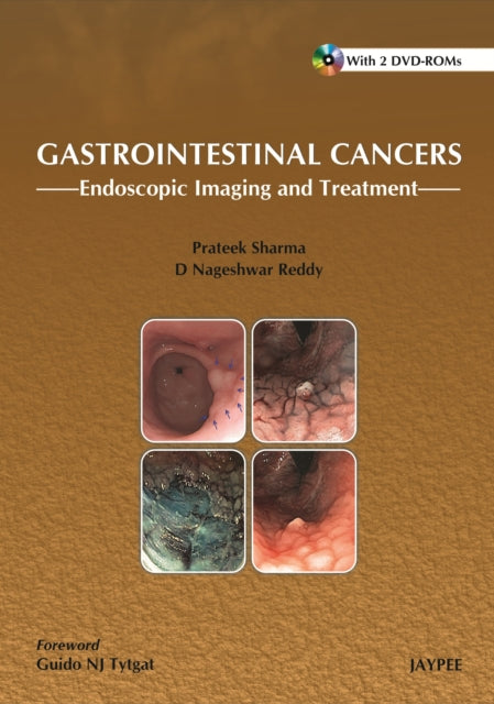 Gastrointestinal Cancers