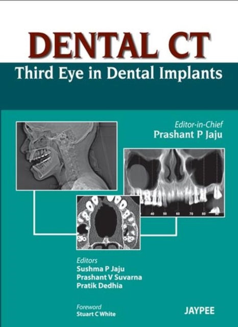 Dental CT Third Eye in Dental Implants