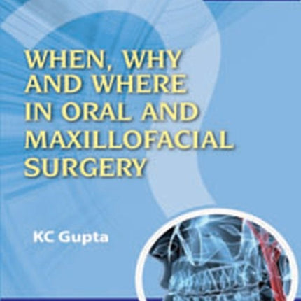 When, Why And Where In Oral And Maxillofacial Surgery: Prep Manual For Undergraduates And Postgraduates Part II