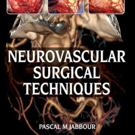 Neurovascular Surgical Techniques