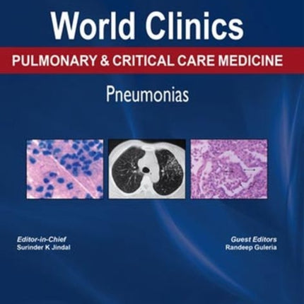 World Clinics: Pulmonary & Critical Care Medicine: Pneumonias