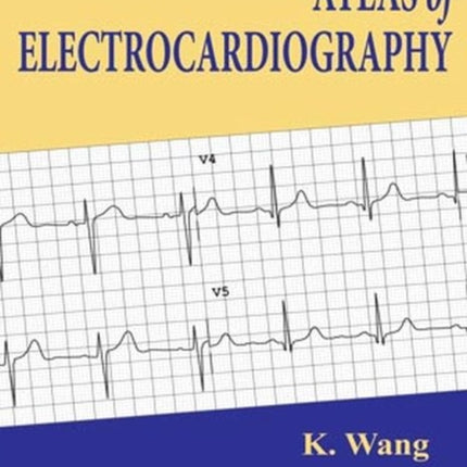 Atlas of Electrocardiography