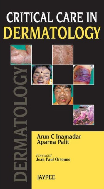 Critical Care in Dermatology