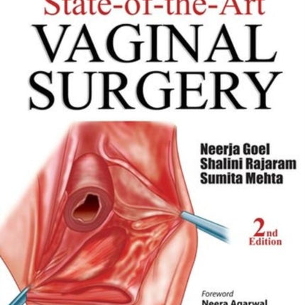 State-of-the-Art Vaginal Surgery