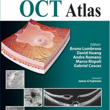 Clinical En Face OCT Atlas