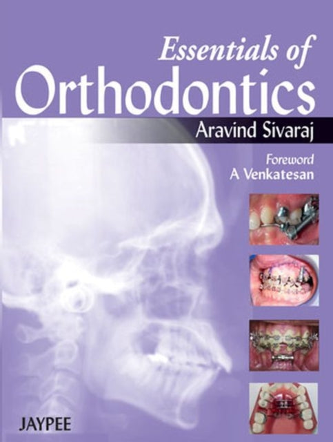 Essentials of Orthodontics
