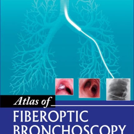 Atlas of Fiberoptic Bronchoscopy