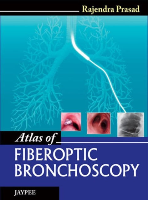 Atlas of Fiberoptic Bronchoscopy