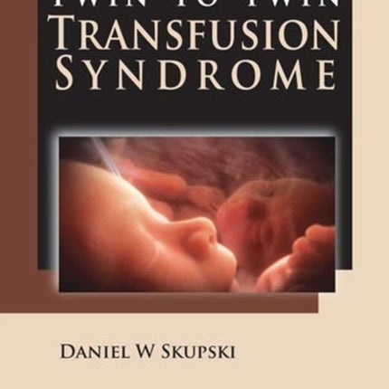 Twin-to-Twin Transfusion Syndrome