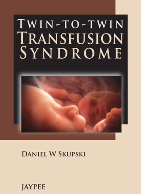 Twin-to-Twin Transfusion Syndrome