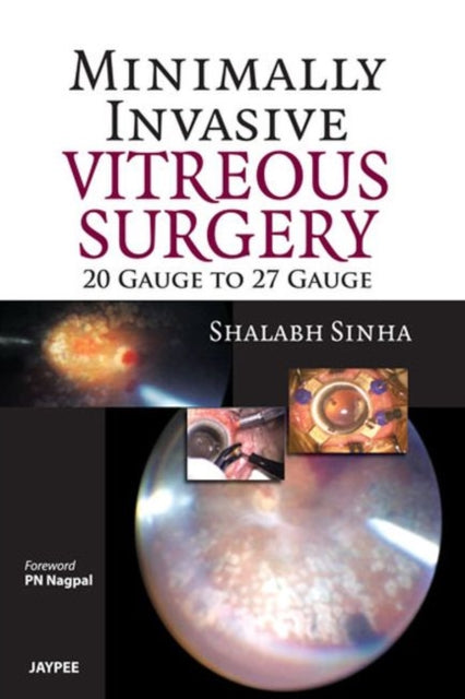 Minimally Invasive Vitreous Surgery: 20 Gauge to 27 Gauge