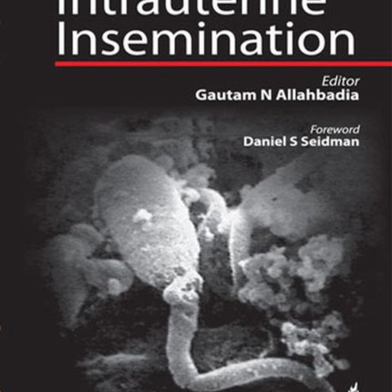 Intrauterine Insemination