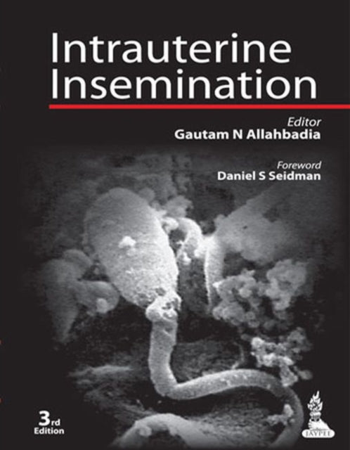 Intrauterine Insemination