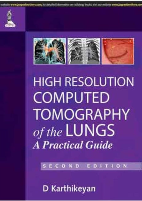 High Resolution Computed Tomography of the Lungs: A Practical Guide