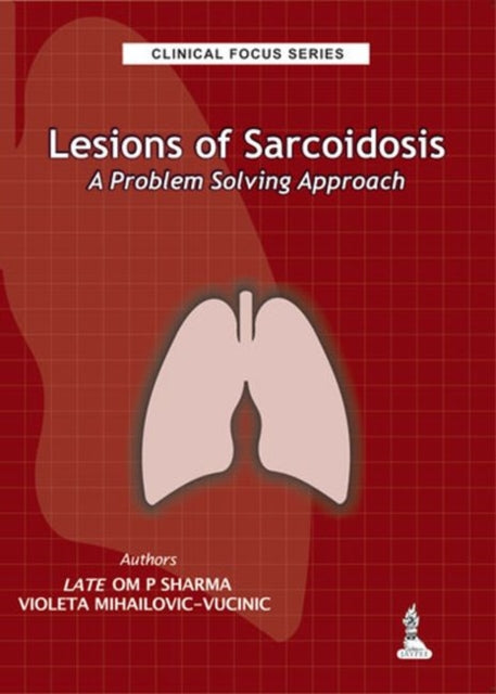 Clinical Focus Series: Lesions of Sarcoidosis: A Problem Solving Approach