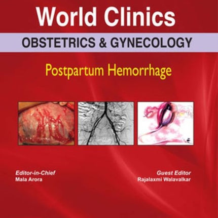 World Clinics: Obstetrics & Gynecology: Postpartum Hemorrhage