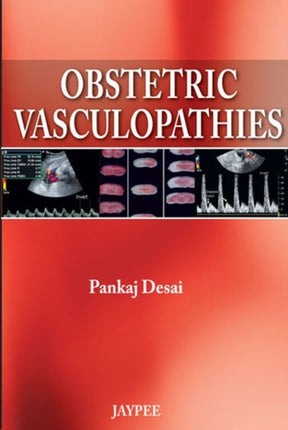 Obstetric Vasculopathies