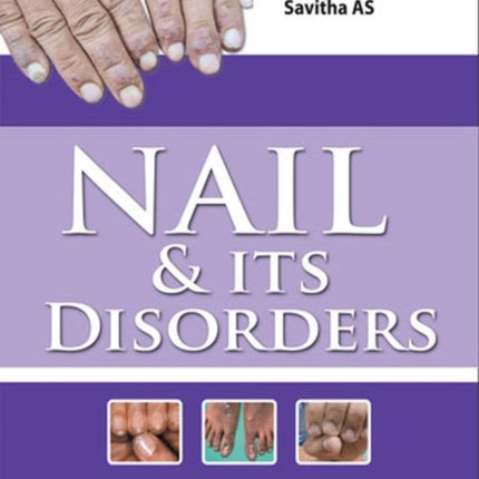 Nail & Its Disorders