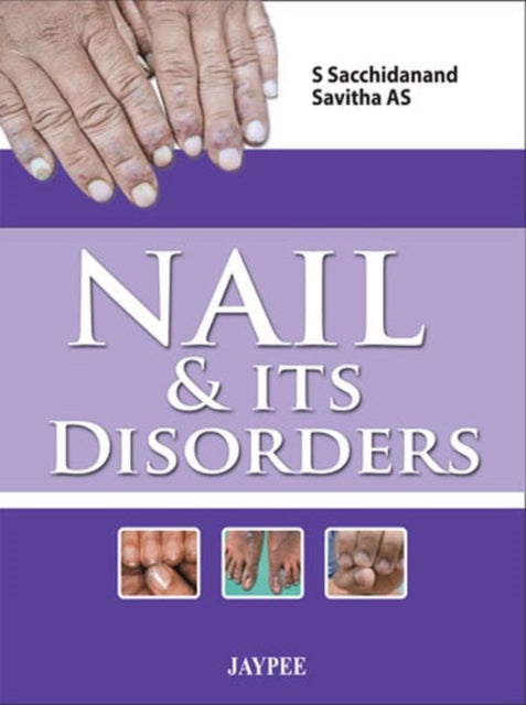 Nail & Its Disorders