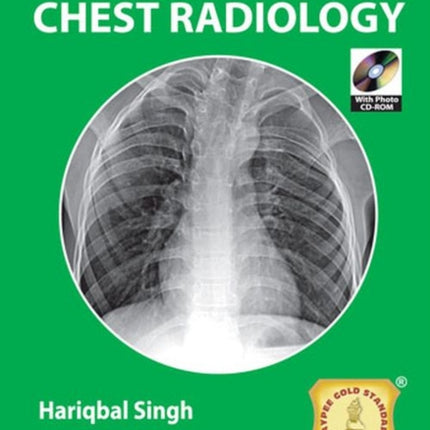 Jaypee Gold Standard Mini Atlas Series: Chest Radiology