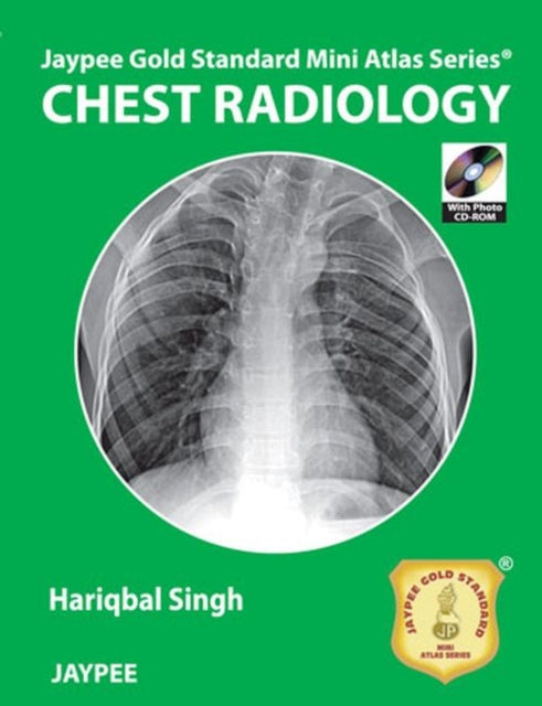 Jaypee Gold Standard Mini Atlas Series: Chest Radiology