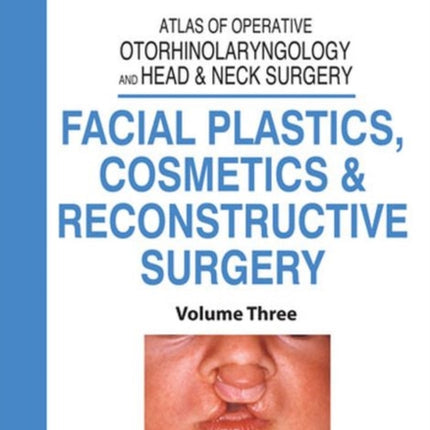 Atlas of Operative Otorhinolaryngology and Head & Neck Surgery: Facial Plastics, Cosmetics and Reconstructive Surgery