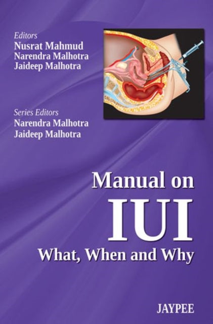 Manual on IUI: What, When and Why