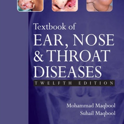 Textbook of Ear, Nose and Throat Diseases