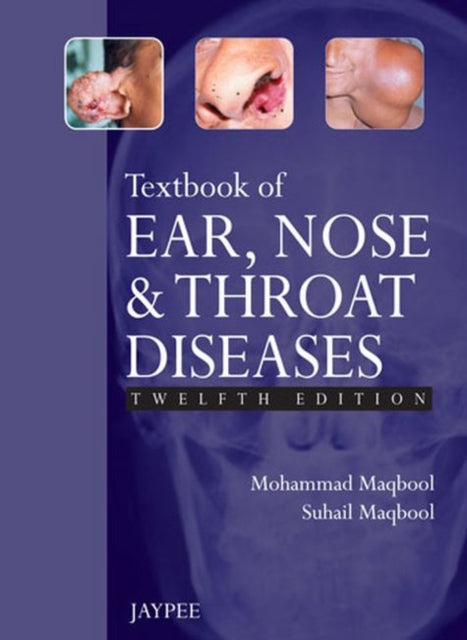 Textbook of Ear, Nose and Throat Diseases